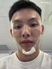 昨日被穆迪肘击!徐杰前往医院治疗,下巴缝针